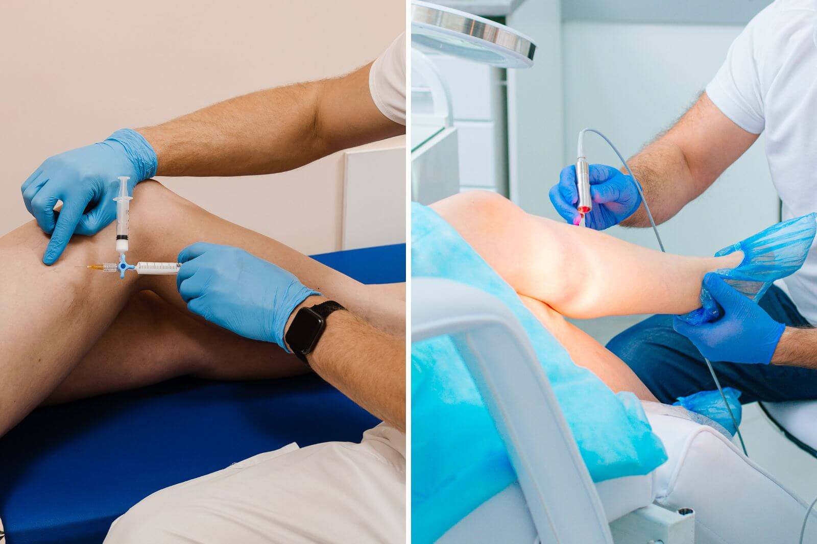 Sclerotherapy vs Laser For Spider Veins On Legs