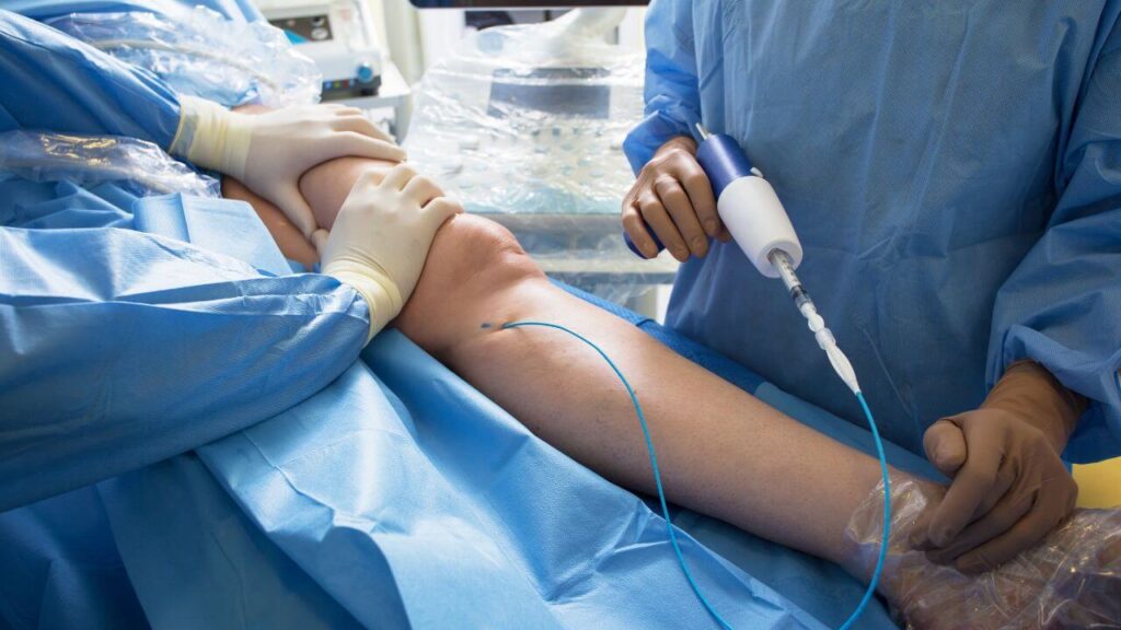 Vein treatment for swelling legs