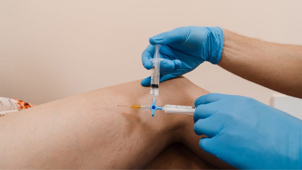 A vein doctor injects Sclerotherapy into his patient's leg