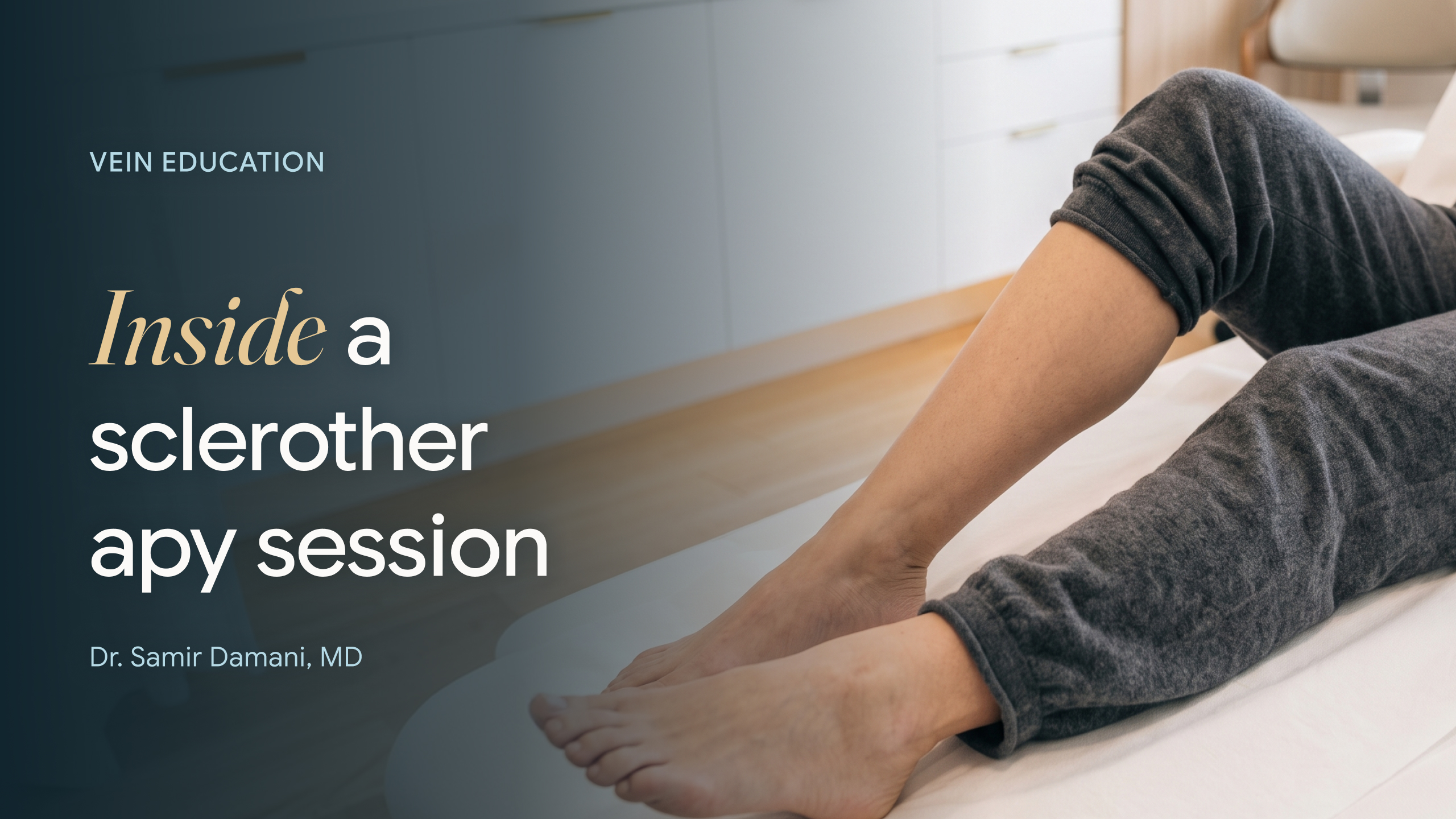 What is Sclerotherapy - Thumbnail