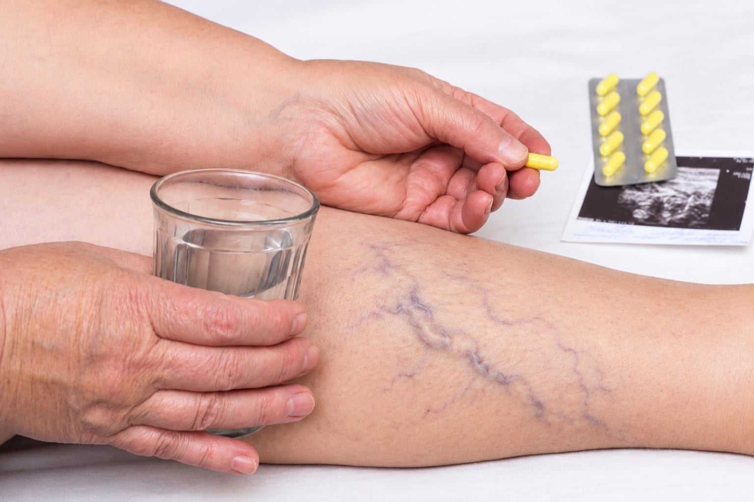 A-man-who-wants-to-take-painkillers-for-varicose-veins