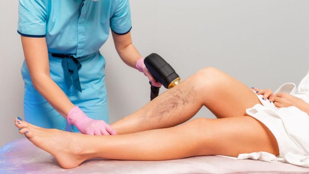 Laser vein removal therapy