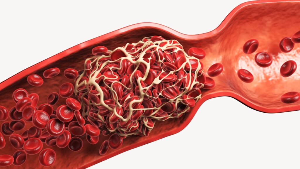 Blood clots illustration