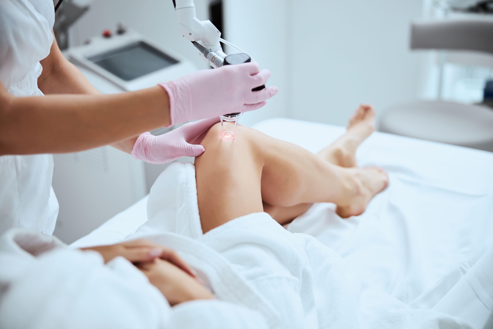 Laser Therapy for Spider Veins
