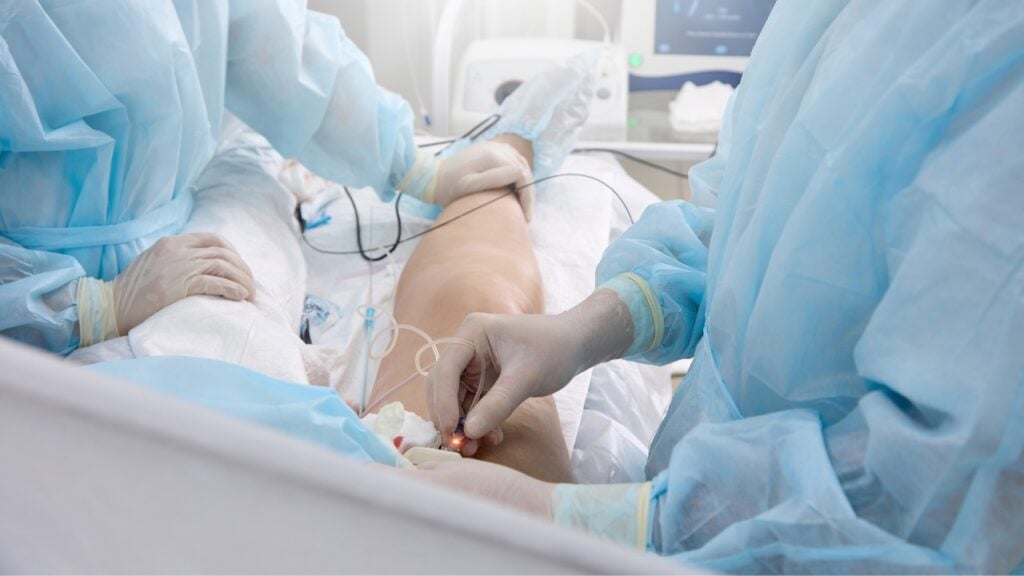 Varicose vein treatments