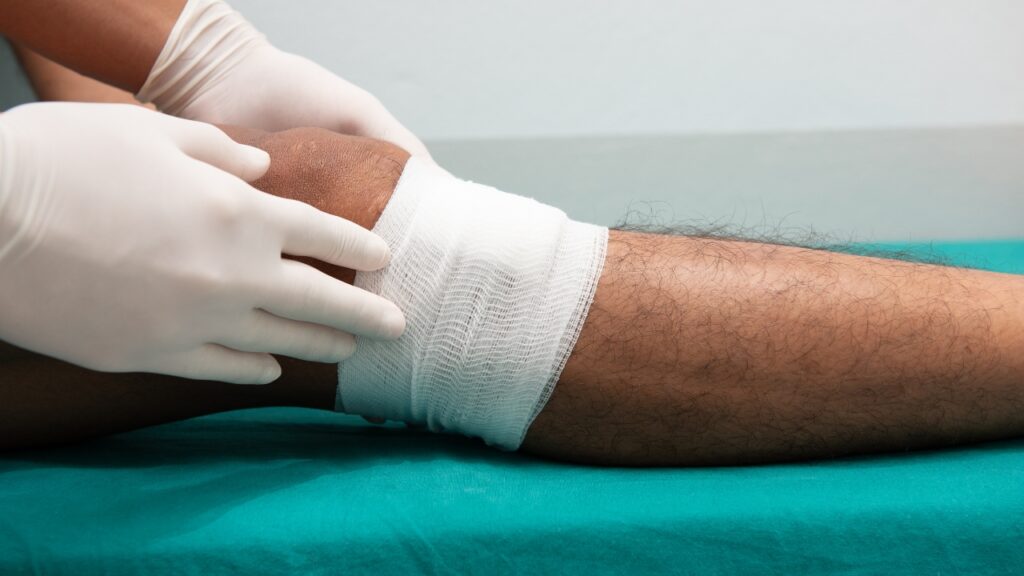 Venous leg ulcers