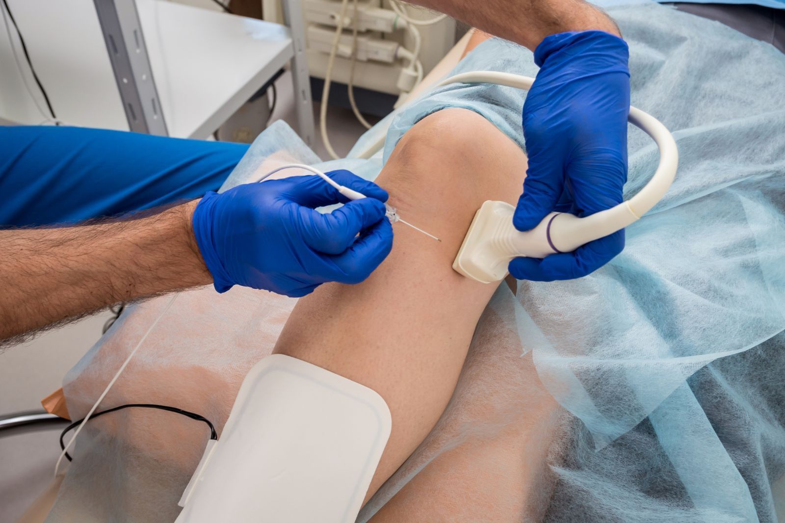 A vein doctor who is performing vein ablation treatment