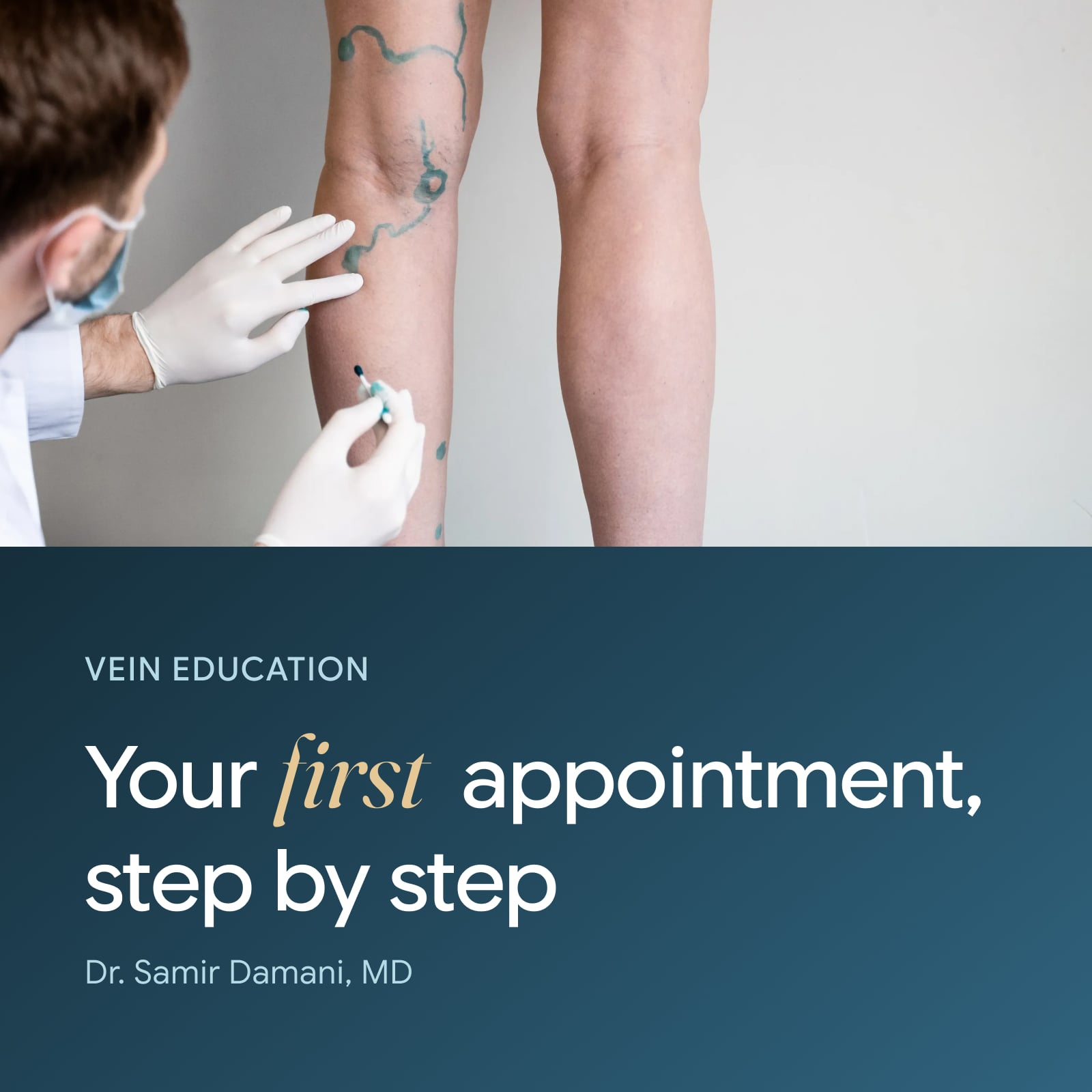 Free Vein Consultation