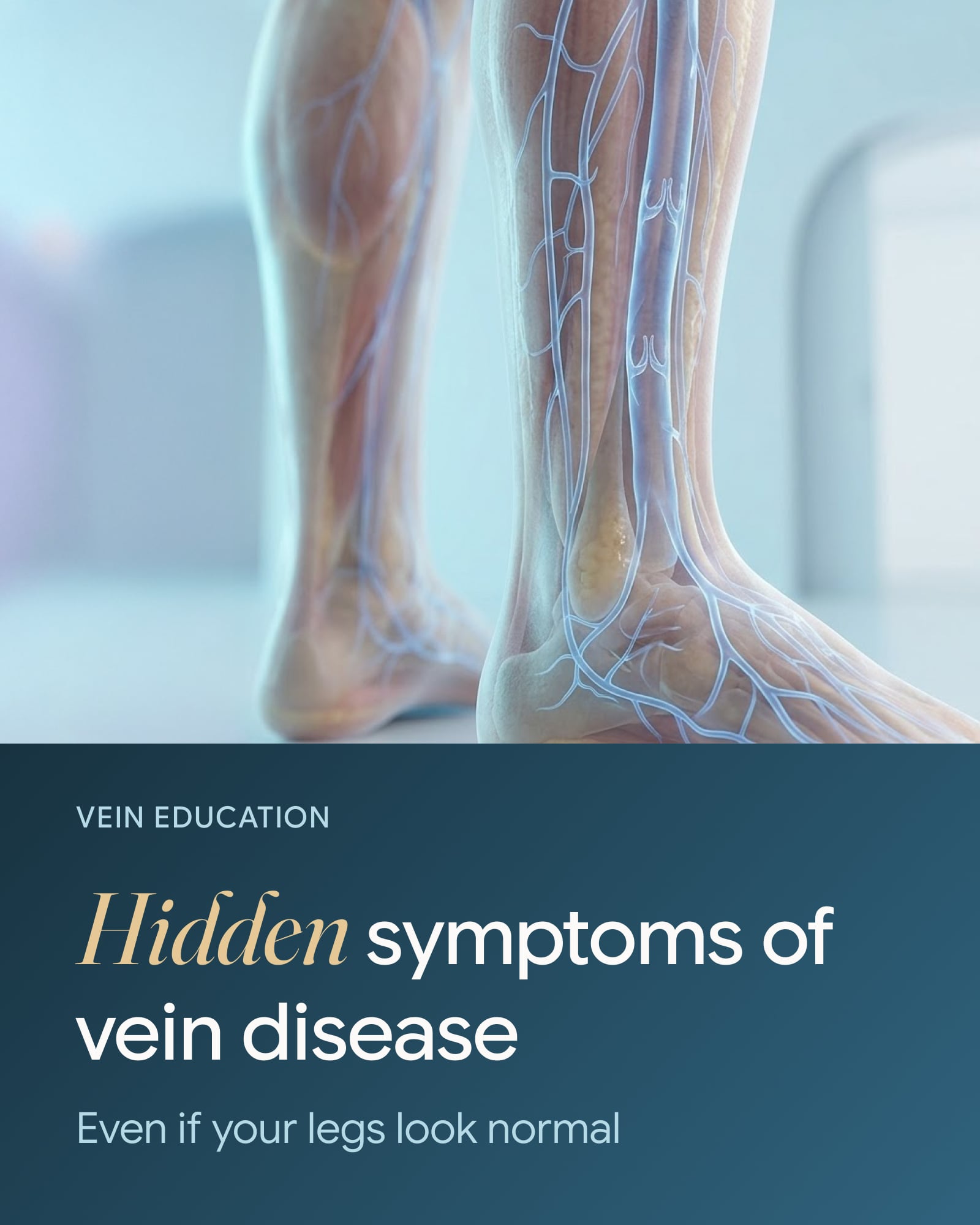 Hidden Vein Disease Signs